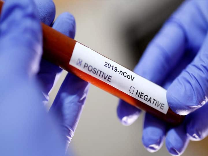 Coronavirus in India Live Updates: तब्लीगी जमात के सदस्यों और पहली बार उनके संपर्क में आए करीब नौ हजार लोग आईसोलेशन में Coronavirus in India news Live Updates Covid 19 Coronavirus total cases in India and Uttar Pradesh Coronavirus in India Live Updates: तब्लीगी जमात के सदस्यों और पहली बार उनके संपर्क में आए करीब नौ हजार लोग आईसोलेशन में